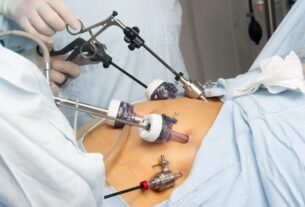 Gastric Sleeve for Weight Loss